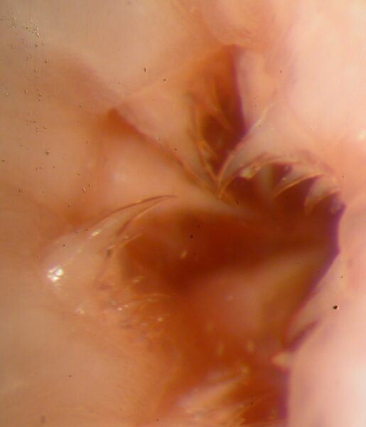 The Mouth of Priapulus caudatus