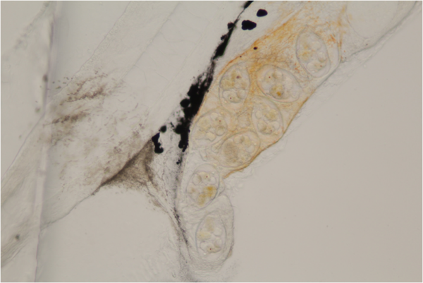 Colurella adriatica in the gut of a first feeding yellow tang larvae. Photo credit: Matthew L. Wittenrich